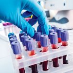 prothrombin time