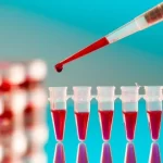 blood tests